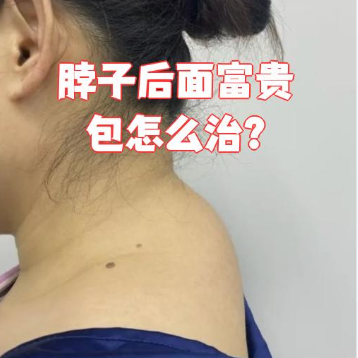 富贵包