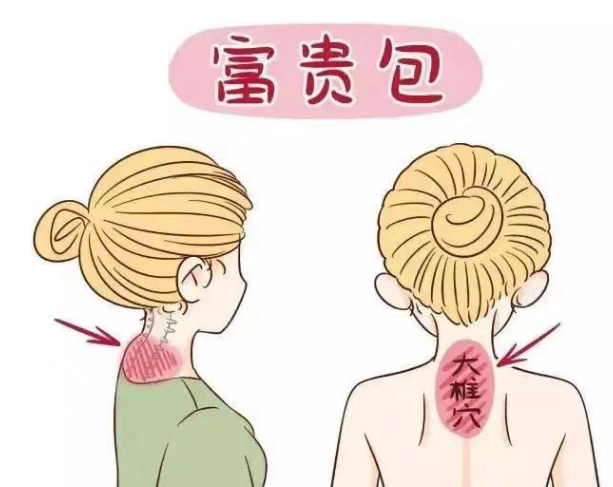 富贵包