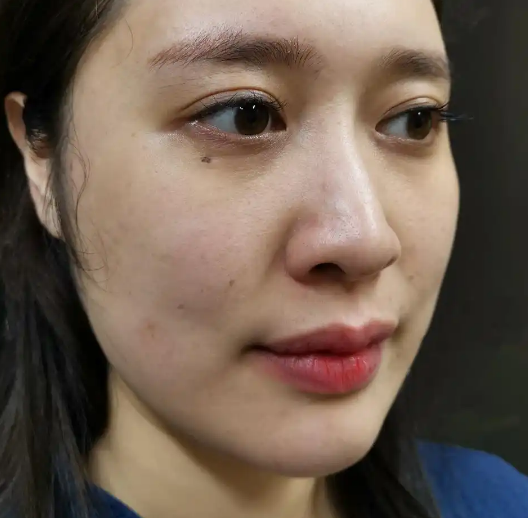 双下巴