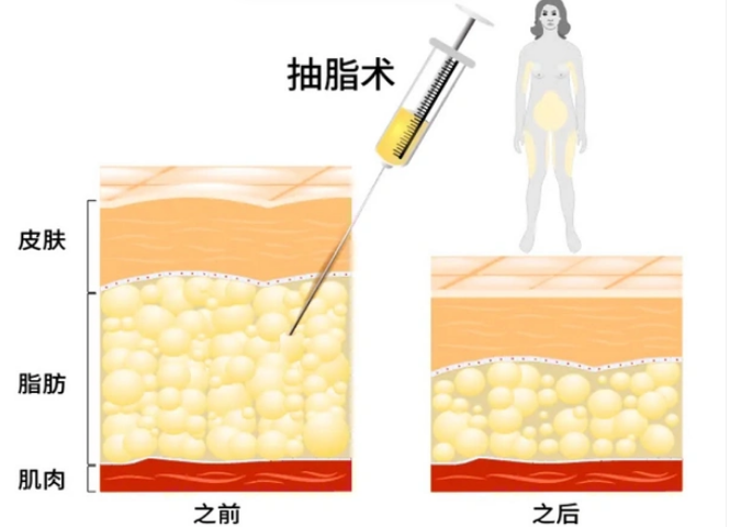 富贵包
