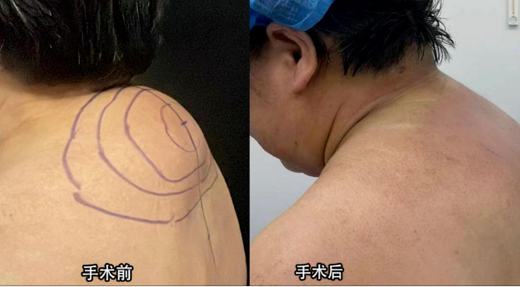 富贵包