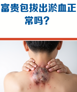 富贵包