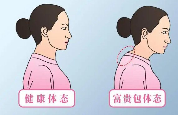 富贵包