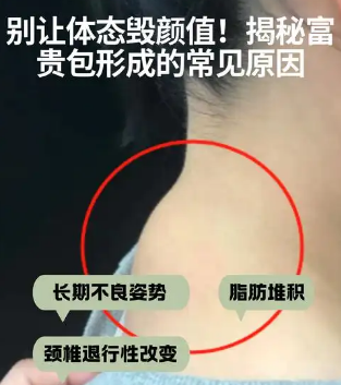 富贵包
