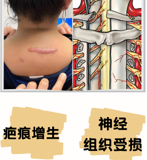 富贵包