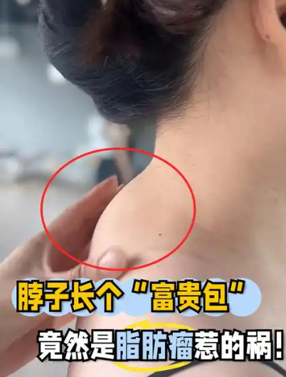 富贵包