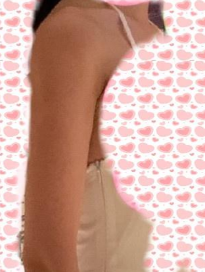 超声波减肥