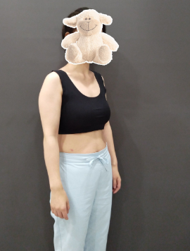 超声波减肥