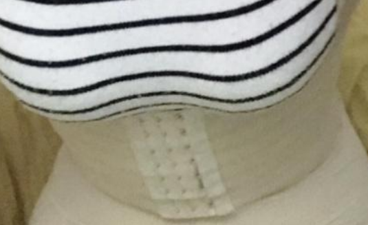 超声波减肥