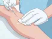 超声波减肥