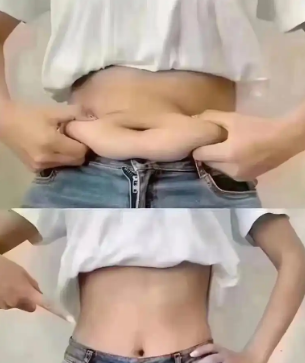 超声波减肥