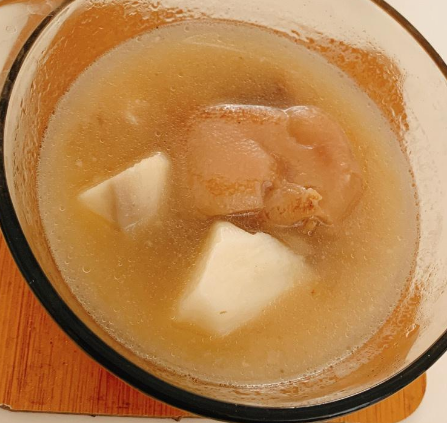 超声波减肥