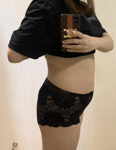超声波减肥