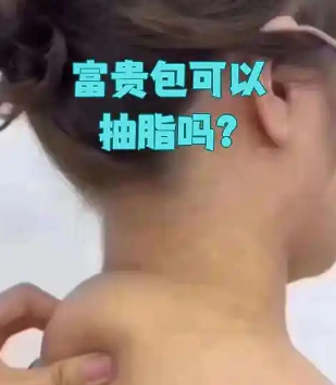 富贵包