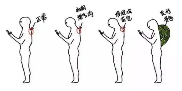 富贵包