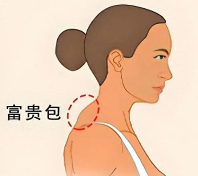 富贵包