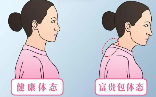 富贵包