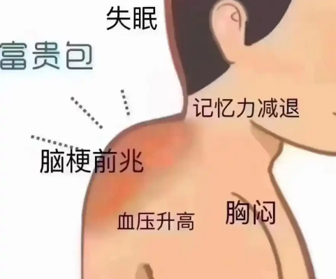 富贵包