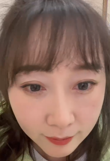 去眼袋手术