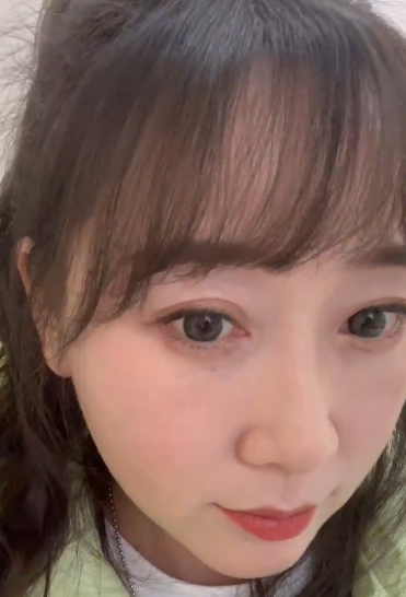 去眼袋手术