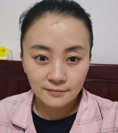 去眼袋手术