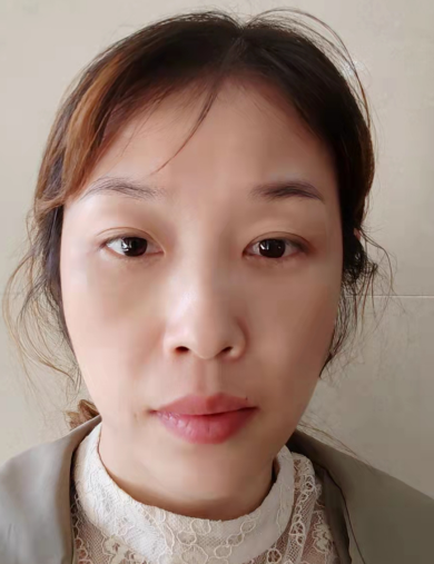去眼袋手术