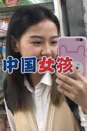 去眼袋手术