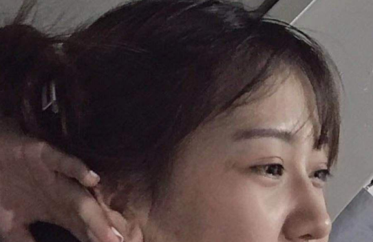 去眼袋手术