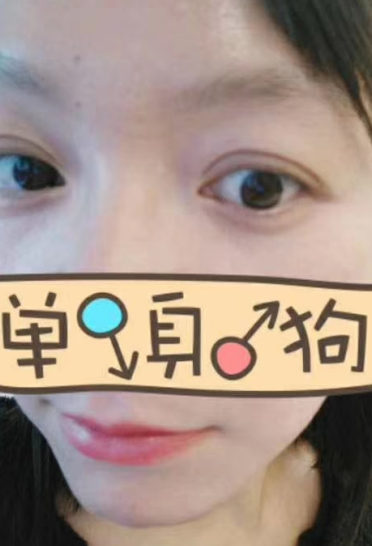 去眼袋手术