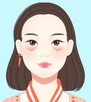 去眼袋手术