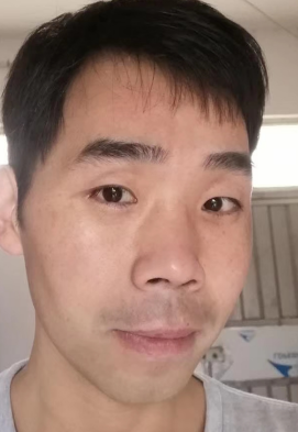 去眼袋手术