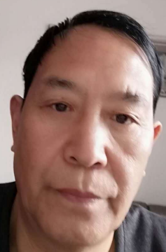 去眼袋手术