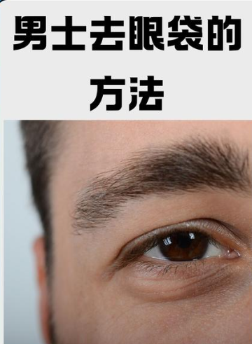 去眼袋手术
