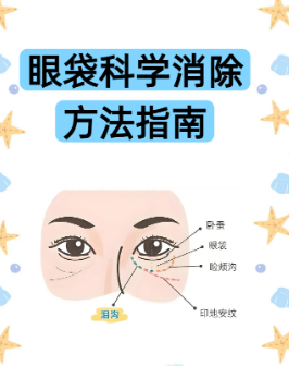 去眼袋手术