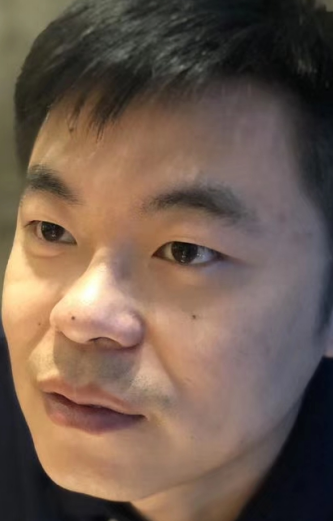去眼袋手术