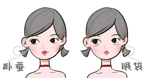 去眼袋手术