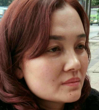 去眼袋手术