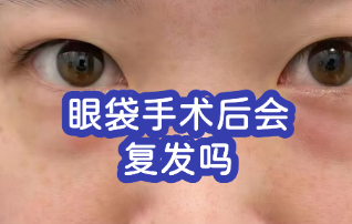 去眼袋手术