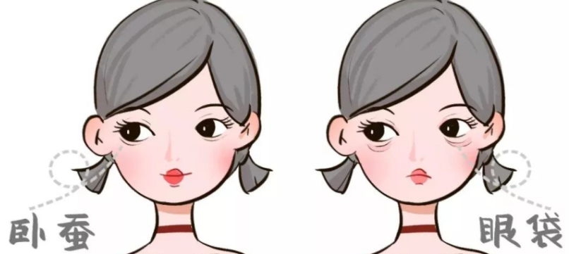 去眼袋手术