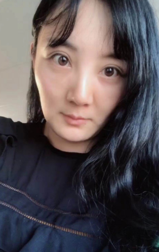 去眼袋手术