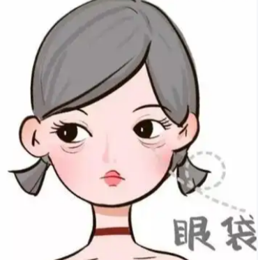 去眼袋手术