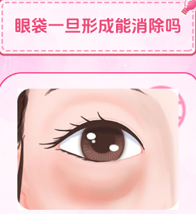 去眼袋手术