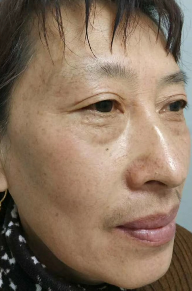 ȥ�۴�����