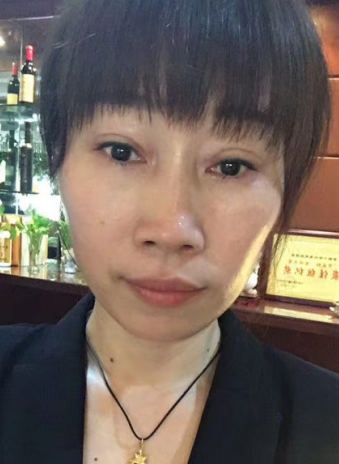去眼袋手术