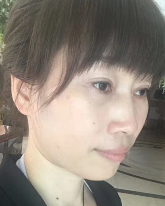 去眼袋手术