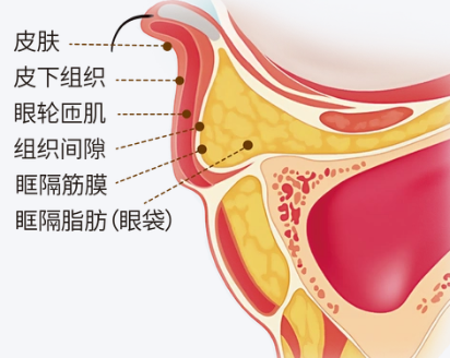去眼袋手术