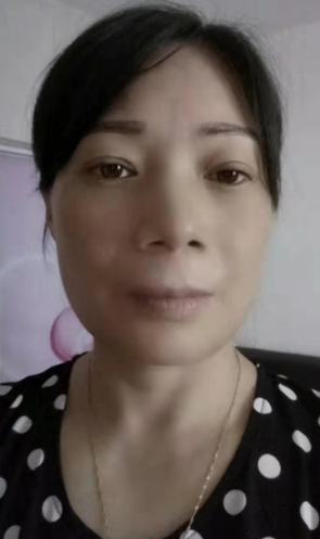 去眼袋手术