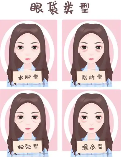 去眼袋手术