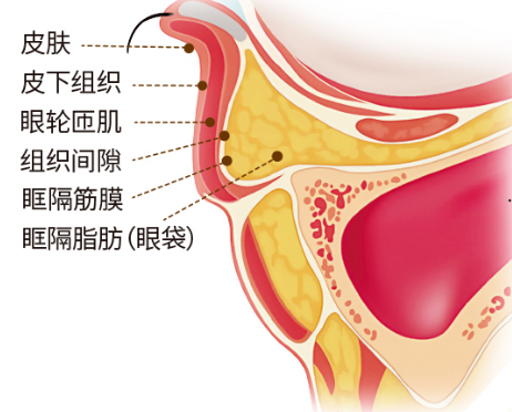 去眼袋手术