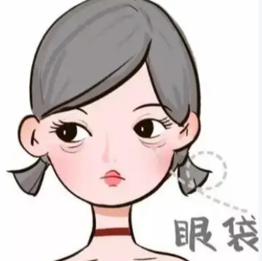 去眼袋手术